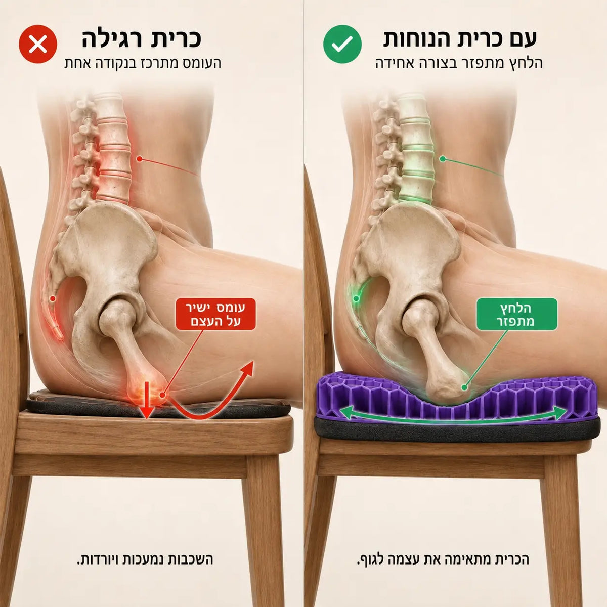 +Softi כרית ג'ל למושב להקלה בכאבי טחורים וישיבה ממושכת